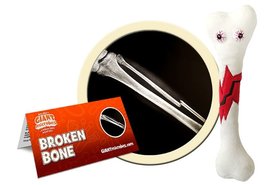 Giant Microbes Orgaan - Wetenschap biologie gebroken bot (botbreuk)